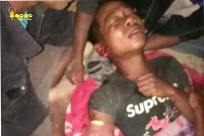 မောင်တောအင်းဒင်ရွာမှ လူငယ်တစ်ဦး သေနတ်ကျည်ဆံထိမှန်ဒဏ်ရာရ