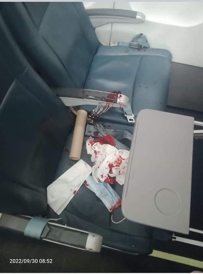 လွိုင်ကော်လေယာဉ်ကွင်းတွင် ခရီးသည်တင်လေယာဥ်ဆင်းသက်စဉ် သေနတ်ပစ်ခတ်ခံရ၍ တစ်ဦးဒဏ်ရာရ